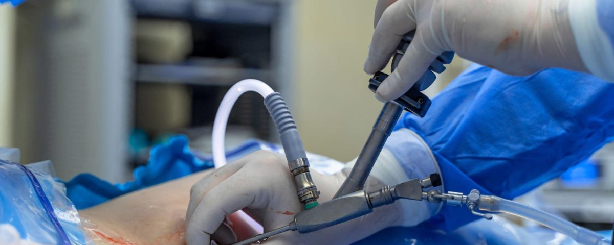 Robotic Hernia Treatment