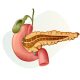 pancreatic cancer